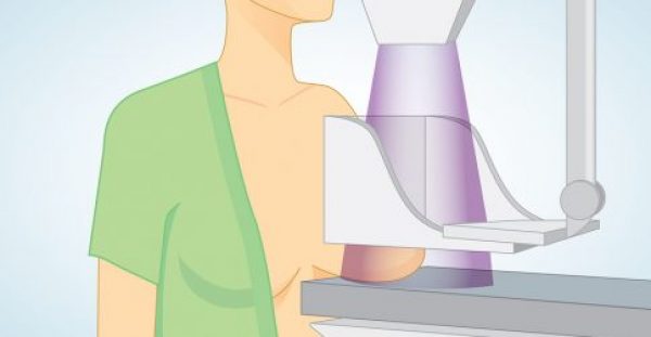 Εξογκώματα στο στήθος: 5 πιθανές αιτίες