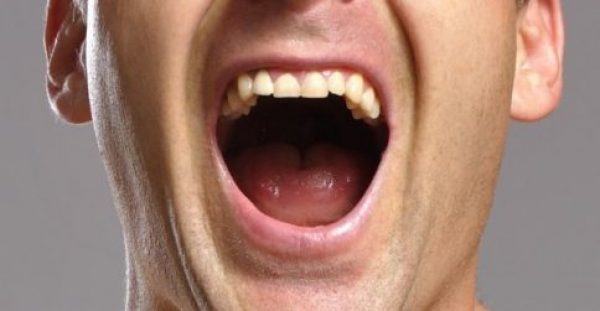 Καρκίνος του στόματος: Χτυπάει ακόμα και πριν τα 30 – Τι να ξέρετε για την πρώιμη διάγνωση