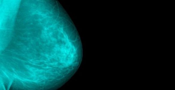 Καρκίνος μαστού: 4 ανησυχητικά σημάδια εκτός από τους ψηλαφητούς όγκους