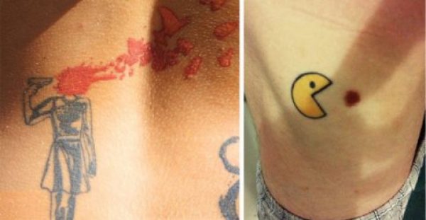 40 εκπληκτικά τατουάζ που καλύπτουν με έξυπνο τρόπο σημάδια εκ γενετής