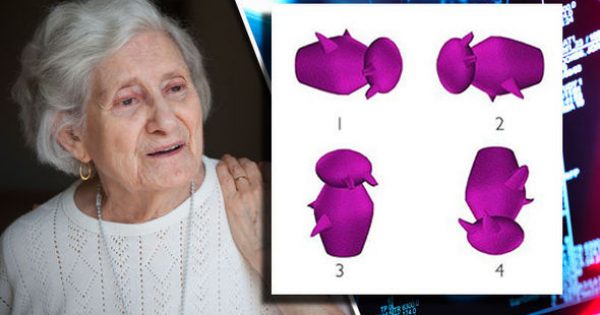 Τεστ για Αλτσχάιμερ: Βλέπετε ποιο σχήμα διαφέρει από τα άλλα; Τι λένε επιστήμονες! [pics]