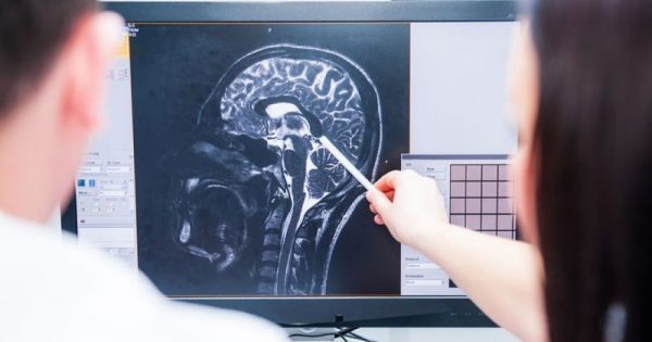 Featured Image for Έρευνα: Η σχιζοφρένεια διαταράσσει όλο το σύστημα επικοινωνιών του εγκεφάλου!!!