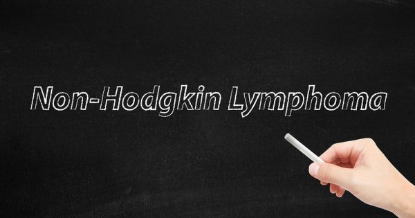 Μη-Hodgkin λεμφώματα: Η συχνότερη αιματολογική κακοήθεια