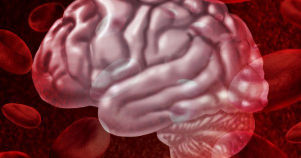 Νέα μέθοδος Brainpath για τις εγκεφαλικές αιμορραγίες και τους όγκους