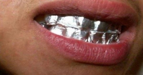 Ξέρετε τι θα συμβεί, αν βάλετε φύλλο αλουμινίου στα δόντια σας για 1 ώρα;