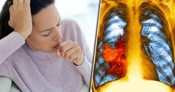 Featured Image for Καρκίνος του πνεύμονα – Συμπτώματα: Ο βήχας και η κόπωση μπορεί να είναι σημάδια