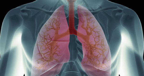 Πνευμονικό οίδημα: Προσοχή στα συμπτώματα – Τι πρέπει να κάνετε άμεσα!