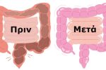 Featured Image for Πως καθαρίζουμε το έντερό μας;