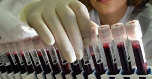 Εξέταση αίματος «προβλέπει» το έμφραγμα 5 χρόνια πριν συμβεί