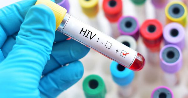 Nέα κάψουλα αργής αποδέσμευσης απλοποιεί τη θεραπεία του HIV
