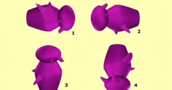 Αλτσχάιμερ – Τεστ: Βρείτε το σχήμα που διαφέρει από τα άλλα [pics]