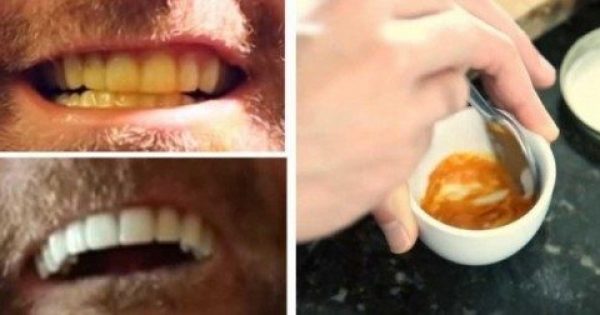 Featured Image for Αυτός ο Άνδρας μας Δείχνει ΠΩΣ να Λευκάνουμε Μόνοι τα Δόντια μας. Καταπληκτικό;