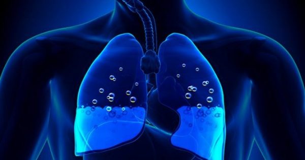 Πνευμονικό οίδημα: Τα σημάδια που δείχνουν συσσώρευση υγρού στον πνεύμονα!