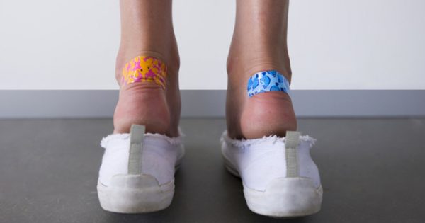 Φουσκάλες από τα παπούτσια: Αυτός είναι ο καλύτερος τρόπος πρόληψης