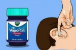 Featured Image for Το Vicks (Βιξ) δεν είναι χρήσιμο μόνο για τα κρυολογήματα. Δείτε 10 έξυπνους τρόπους να βελτιώσετε την υγεία σας.