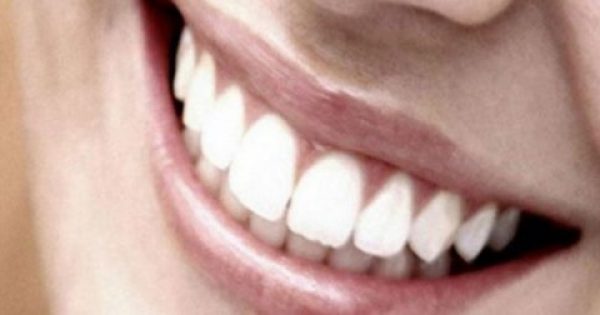 Ένα μεγάλο ΜΠΡΑΒΟ!!! Ελληνίδα επιστήμονας εφηύρε ουσία που αναπλάθει φυσικά τα δόντια!
