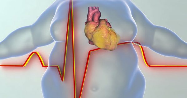 Περιττά κιλά: Πόσο αυξάνουν τον κίνδυνο θανάτου από καρδιαγγειακά αίτια