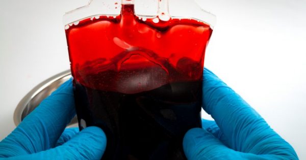Ποια ομάδα αίματος υπερδιπλασιάζει τον κίνδυνο θανάτου από αιμορραγία μετά από σοβαρό τραυματισμό