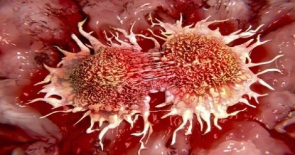 Γιατί κρύβεται από τον κόσμο:10 κύριες αιτίες καρκίνου που χρησιμοποιούμε καθημερινά
