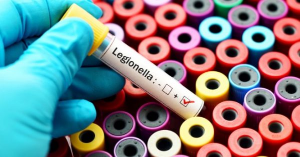 Μάνος Αντώναρος: Πώς κόλλησε πιθανώς το βακτήριο της λεγιονέλλας – Τι συμπτώματα παρουσιάζει