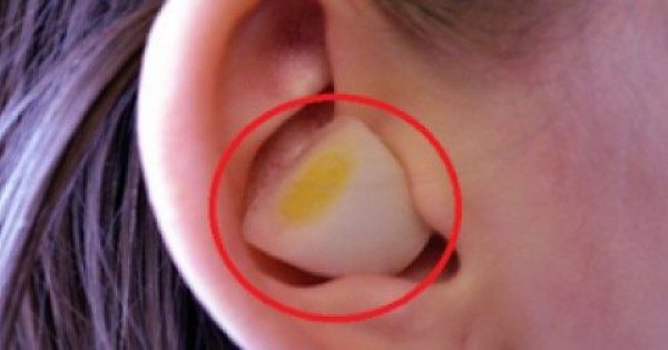 Καταπληκτικό! – Εσείς ξέρατε τι θα συμβεί αν βάλετε σκόρδο στο αυτί σας; Αν ΟΧΙ δείτε το ΕΔΩ!