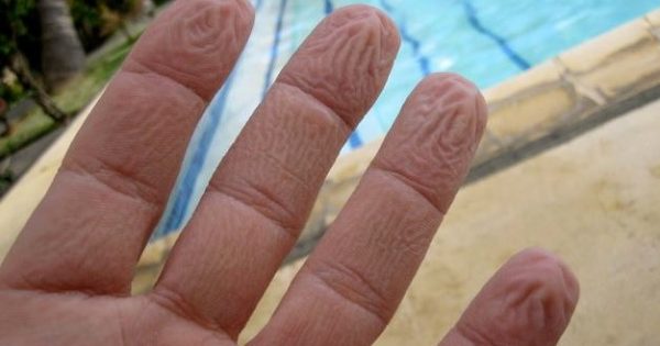 Γιατί ζαρώνουν τα δάχτυλά σας μέσα στο νερό – Όχι, δεν είναι επειδή «μούλιασαν»…