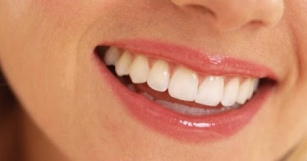 Σφραγίσματα Τέλος! Θεραπεύστε τα χαλασμένα σας δόντια μόνο με… ΔΙΑΤΡΟΦΗ