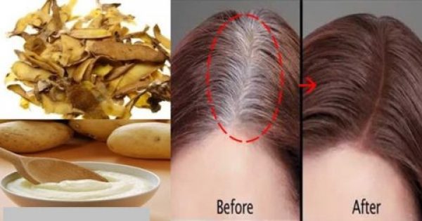 Η λύση σε ένα από τα μεγαλύτερα προβλήματα των γυναικών! Καλύψτε φυσικά τα γκρίζα μαλλιά με την βοήθεια της πατάτας!