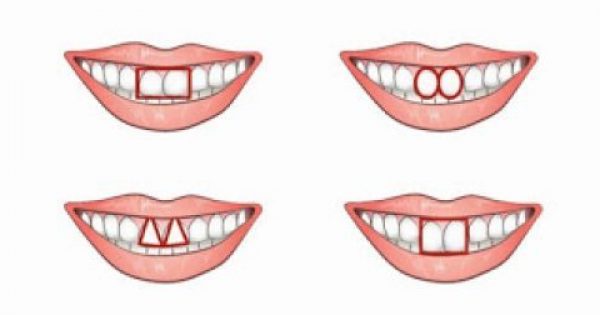 Τα μπροστινά σας δόντια είναι ΈΤΣΙ; Αυτό σημαίνει ότι…