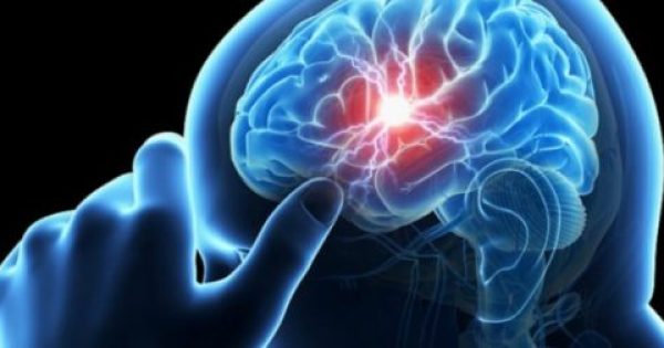 “Μίνι” εγκεφαλικό: Αυτά είναι τα σημάδια που σώζουν ζωές