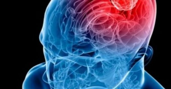 Όγκος στον εγκέφαλο: Τα 8 συμπτώματα που δείχνουν ότι κάτι «τρέχει»