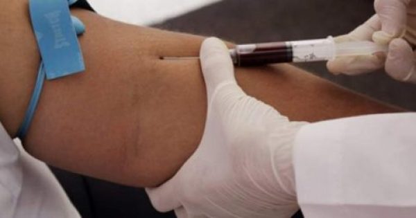Νέο τεστ αίματος προβλέπει την πρόγνωση της Πολλαπλής Σκλήρυνσης