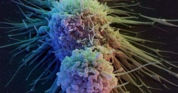 Μια παράδοξη ανακάλυψη για τον καρκίνο