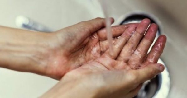 Τα 5 λάθη που κάνεις όταν πλένεις τα χέρια σου και σε γεμίζουν μικρόβια