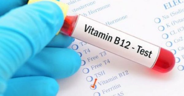 Έλλειψη βιταμίνης Β12: Οι 8 συνηθέστερες αιτίες