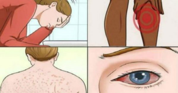 17 Συμπτώματα της ασθένειας της μούχλας και πως να απαλλαγείτε!