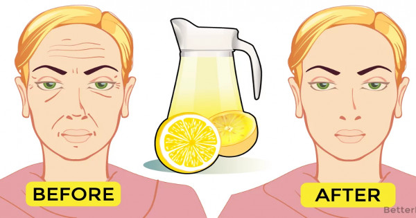 Ρυτίδες τέλος: Δοκιμάστε αυτό το σπιτικό τονωτικό με το λεμόνι και δείξτε πιο φρέσκες στο λεπτό