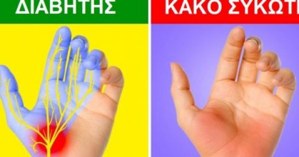 Featured Image for 7 Συμπτώματα στα Χέρια που προκαλούνται από σοβαρές Ασθένειες και Δεν θα πρέπει να τα Αγνοήσετε