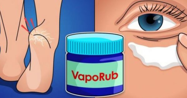 14 εναλλακτικές χρήσεις του VapoRub που θα εύχεστε να γνωρίζατε νωρίτερα