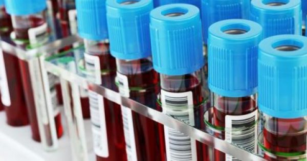 Νέο τεστ αίματος ανιχνεύει οποιονδήποτε καρκίνο μέσα σε 10 λεπτά!