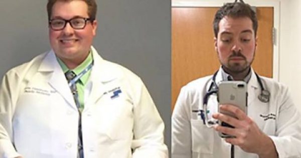 Γιατρός κατάφερε να χάσει 57 κιλά κάνοντας την διαλειμματική νηστεία και έγινε αγνώριστος