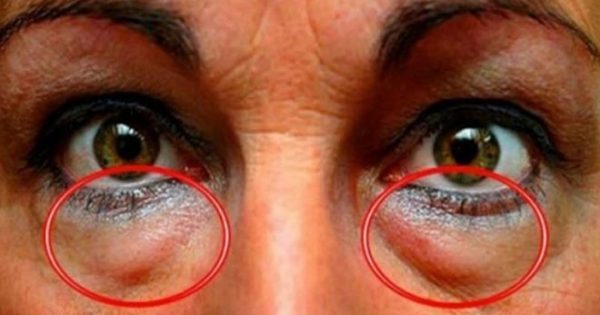 Featured Image for Το ελληνικό μπαχαρικό που προστατεύει τα μάτια από 90 παθήσεις