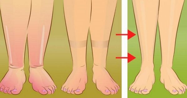 Featured Image for 5 Πρακτικές Συμβουλές για να Ανακουφίσετε τα Πρησμένα Πόδια σας με Τρόπο Φυσικό.
