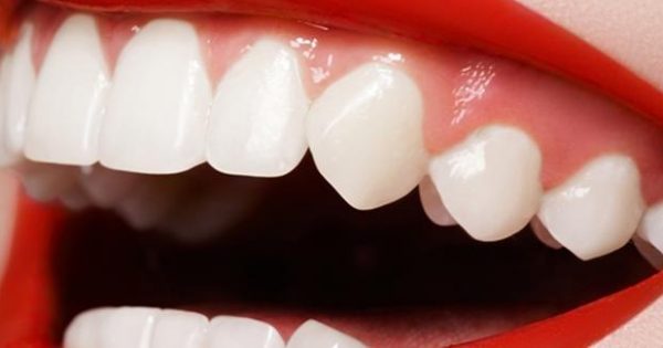 Featured Image for Τα προϊόντα λεύκανσης βλάπτουν τα δόντια… σε βάθος