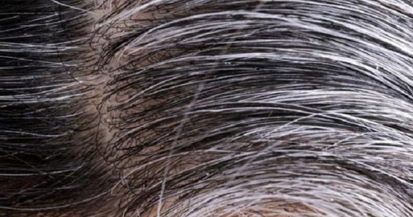 Πρόωρο γκριζάρισμα μαλλιών: Οι επτά πιθανές αιτίες